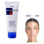 Mistine Acne Clear Facial Foam (Oil Control & Acne Solution Formula) - Image 3
